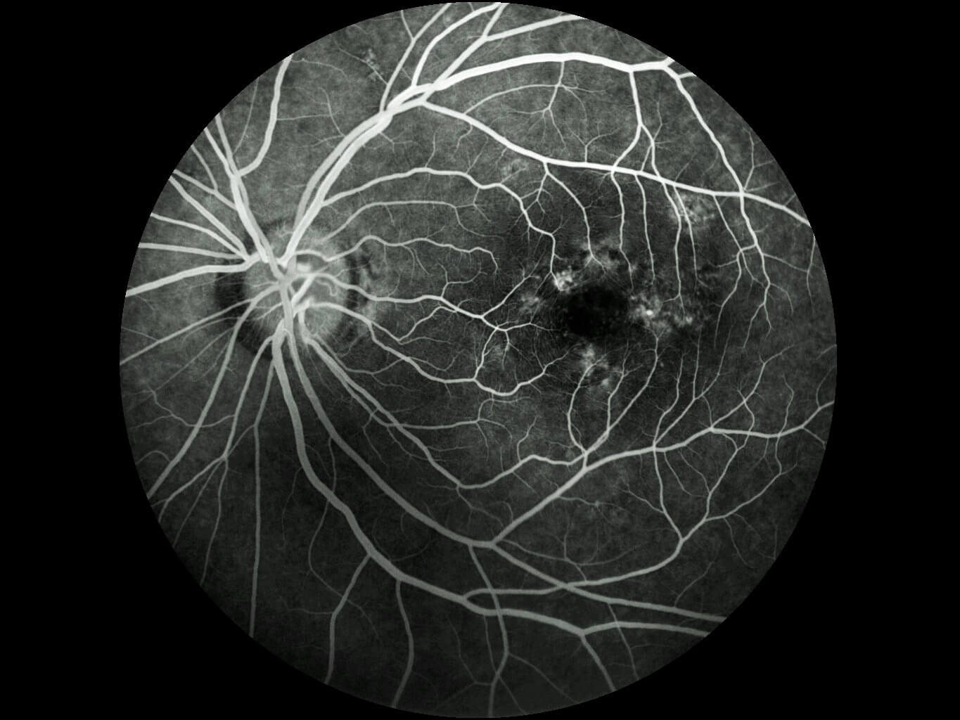 SK-650B Cámara de fondo de ojo no midriática y ANGIOGRAFÍA DE FLUORESCEINA