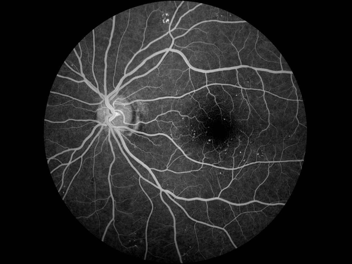 SK-650B Cámara de fondo de ojo no midriática y ANGIOGRAFÍA DE FLUORESCEINA