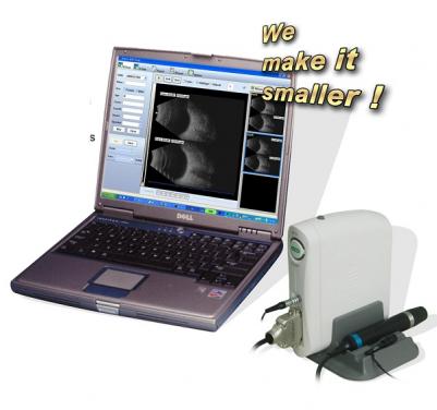 SW-2100 Escáner AB de ultrasonido oftálmico