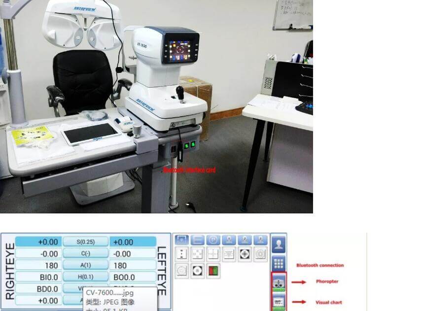 CV-7600 foróptero digital de blue tooth network