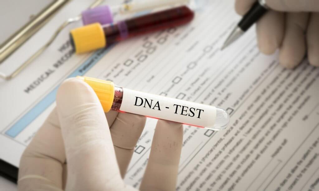 Scientist analyzing DNA result for check genetics and forensics science