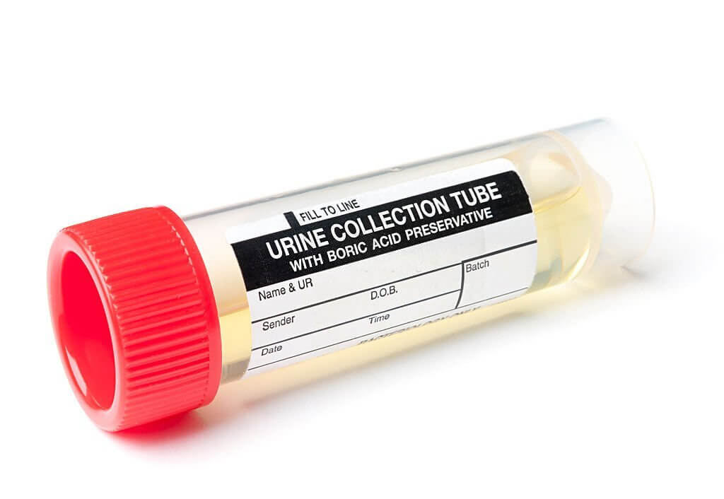 Urine sample collection pot with blank details, isolated on white.