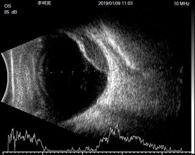 2019 newest model SK-3000 Ultrasound A/B/P