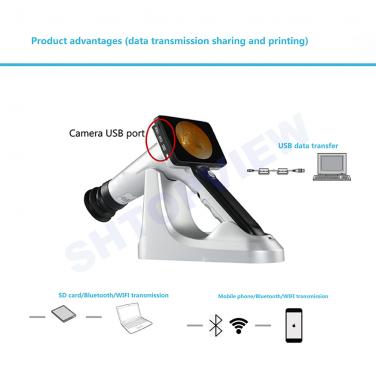 HAND-HELD FUNDUS CAMERA CFC X