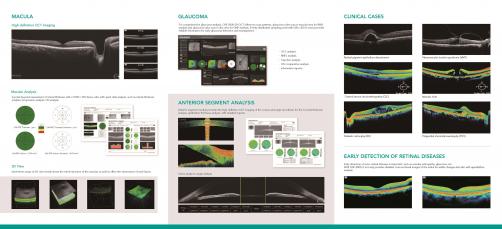 OSE-2800AS Ophthalmic Optical Coherence Tomography (OCT) Machine