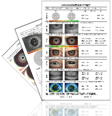 DA-3 OCULAR SURFACE ANALYZER Dry Eye Tester