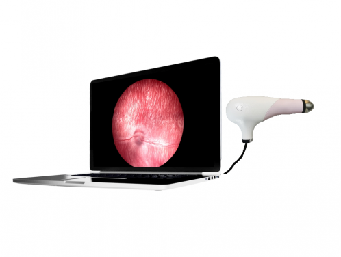 FUNDUS IMAGING SYSTEM SK-8000A/B/C