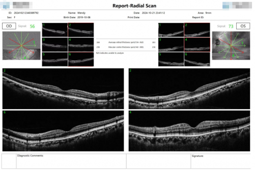 Automatic Artificial Intelligence OCT  BV-1000