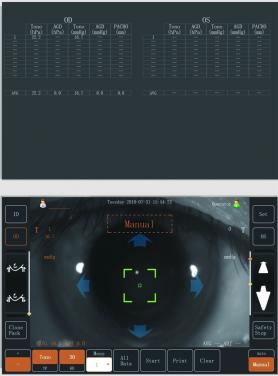 ST-1000 眼科设备非接触式眼压计