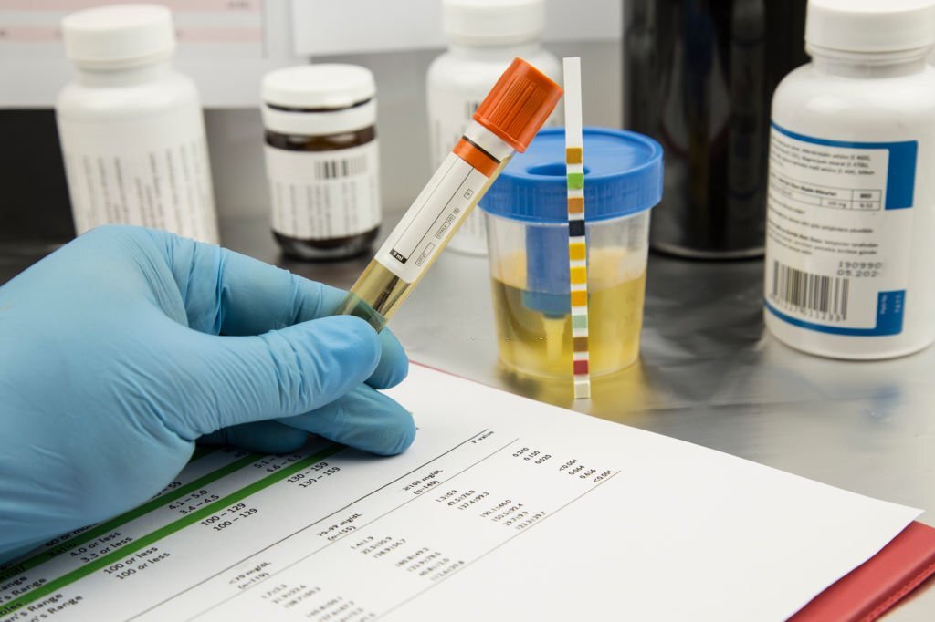 Enhance DNA Extraction from Urine Using Tris-EDTA Treatment