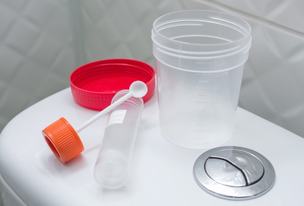 Stool Sample Collection Kits: Methods and Challenges