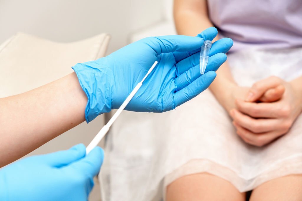 HPV Test Sampling Swabs: Pros, Cons and Guidance