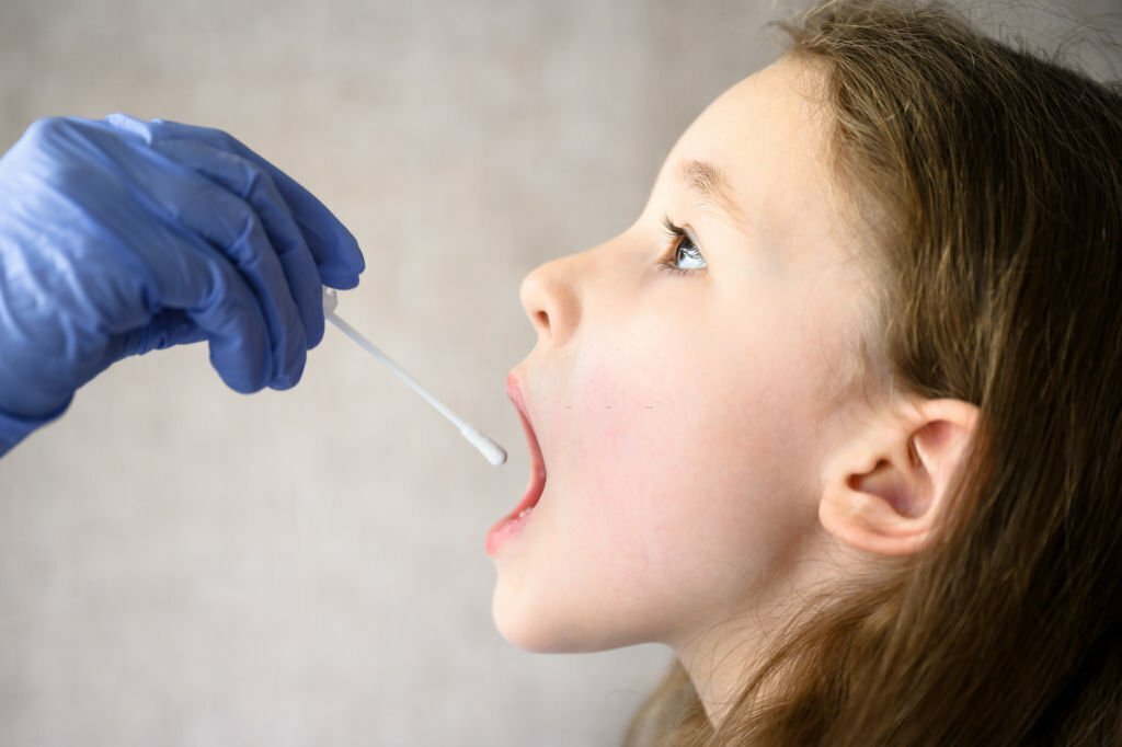The Potential of Oropharyngeal Swabs for Rapid Diagnosis of Community-Acquired Pneumonia