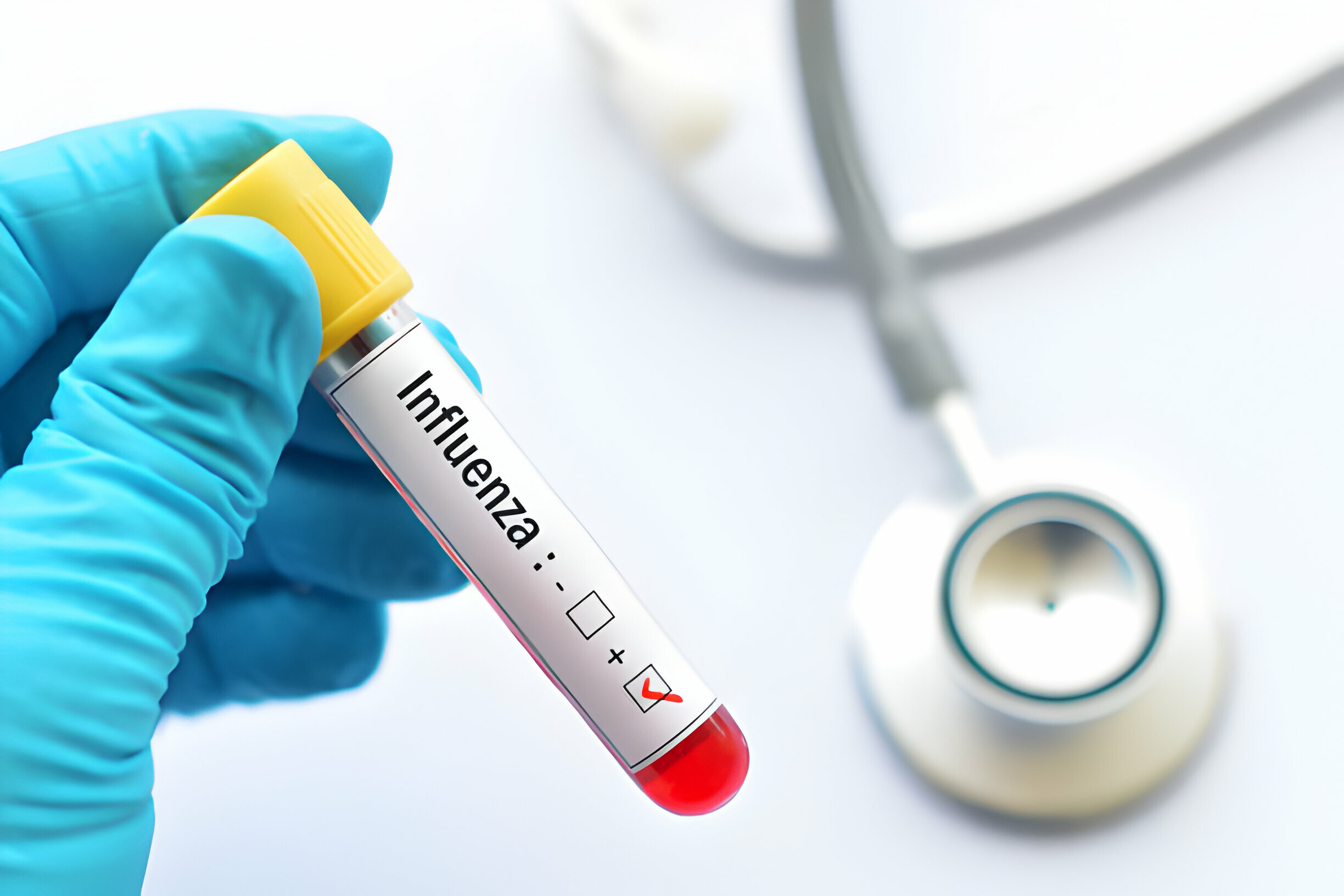 Laboratory Diagnosis of Influenza: A Guide