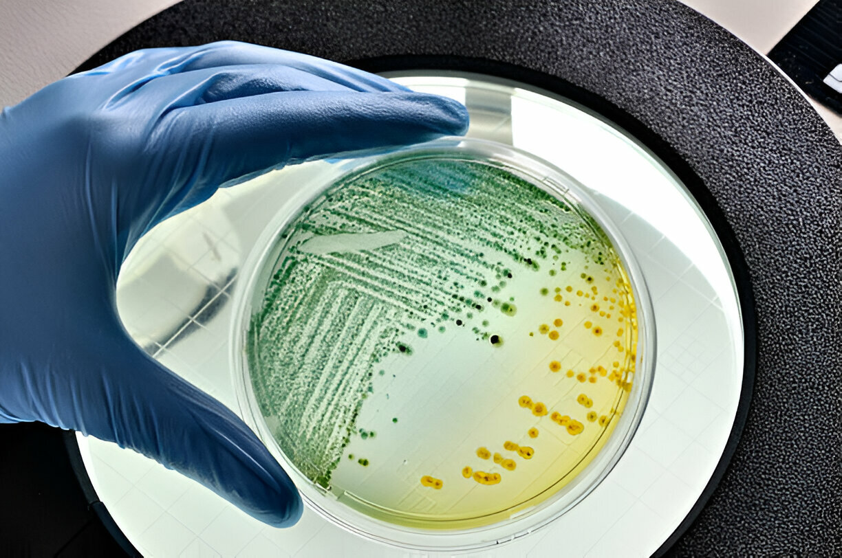 How to Grow Escherichia coli