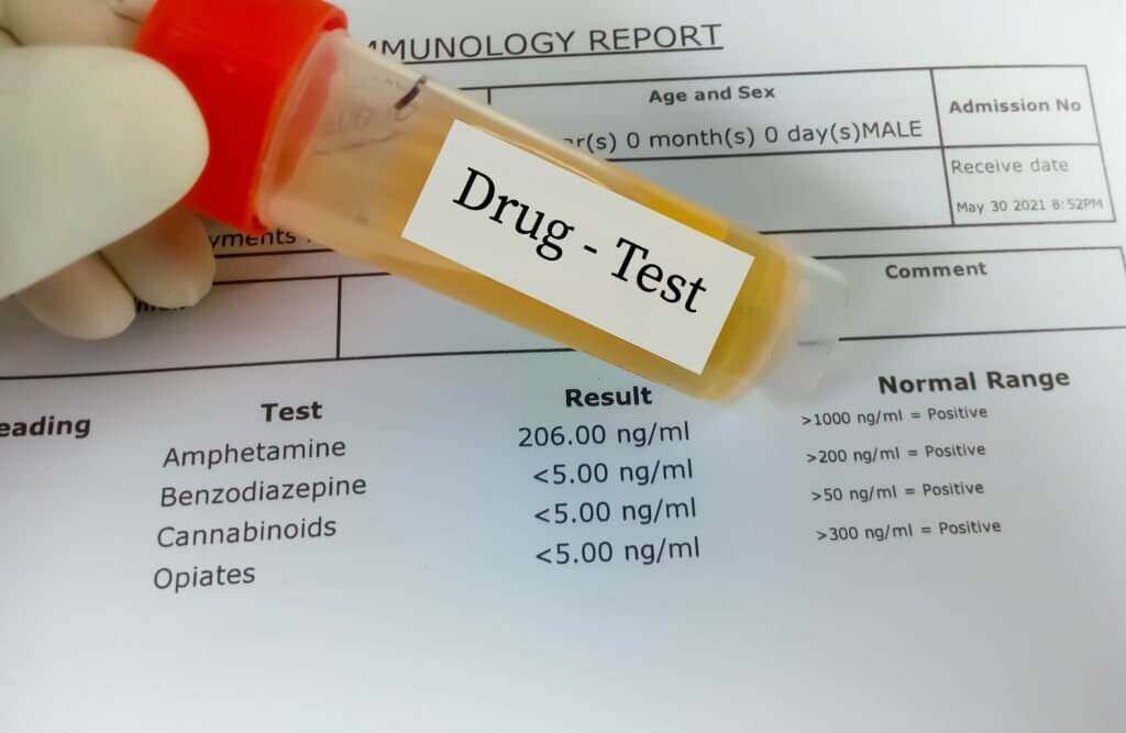 Scientist hold urine sample for drug test. Drug test is technical analysis of specimen to determine illegal drug abuse as Benzodiazepine, Cannabis, amphetamine, opiates.