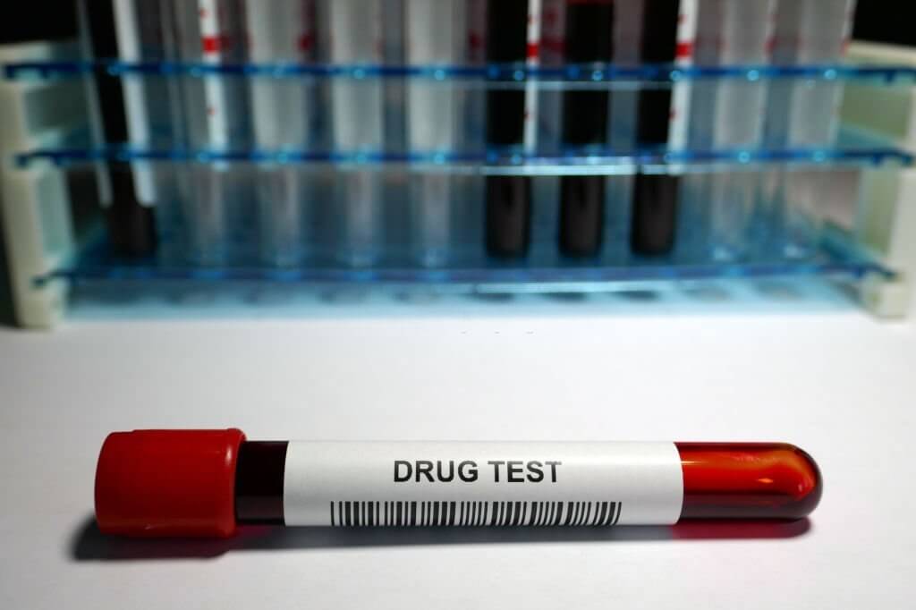 Drug Test - laboratory analysis performed on a blood sample that is extracted from a vein in the arm using a hypodermic needle and vacutainer.