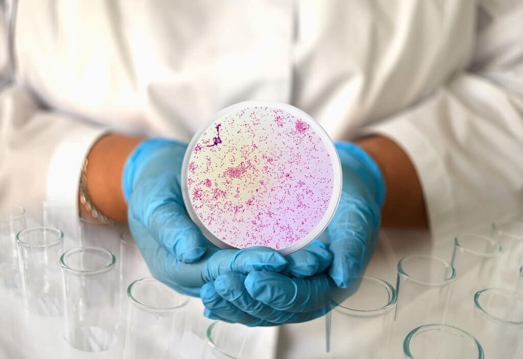 A girl in a medical gown and gloves holds a photo gonorrhea Neisseria gonorrhoeae from a microscope in a round frame.