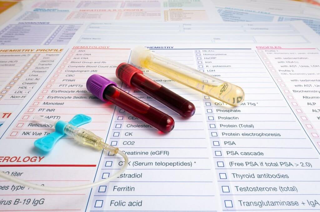 Blood sample and urine collection tubes and supplies with requisition form for analysis in the clinical laboratory