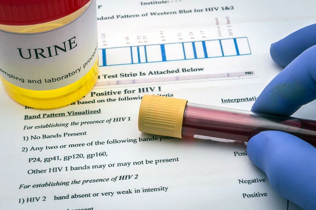 Tests for Research of urine