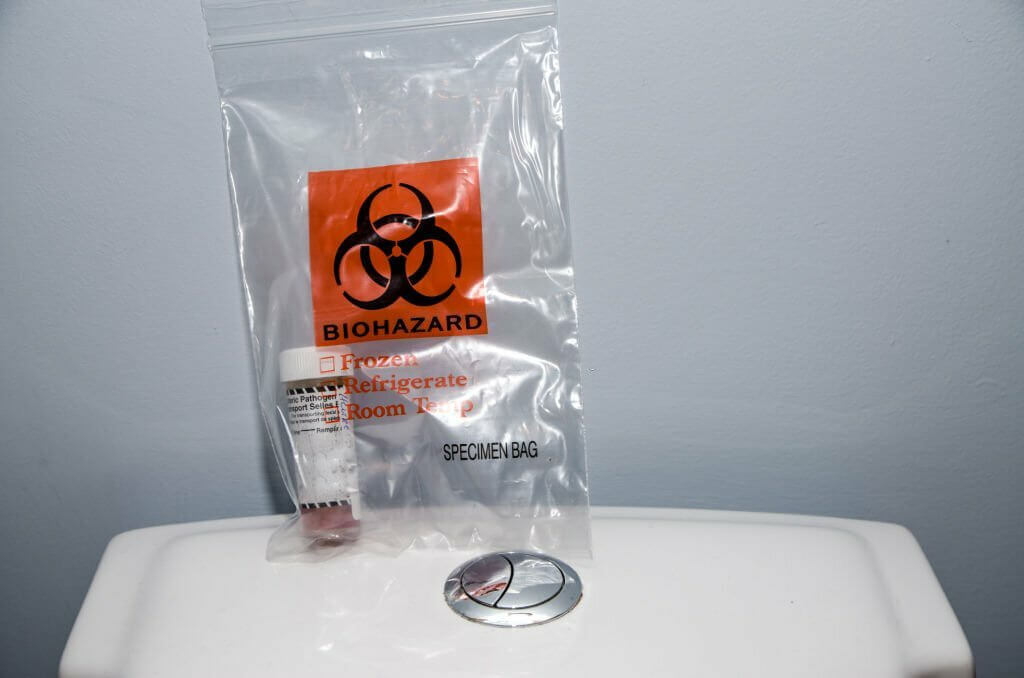 Medical kit for the sampling of feces. Bottle is in a Biohazard specimen plastic bag on top of toilet top.