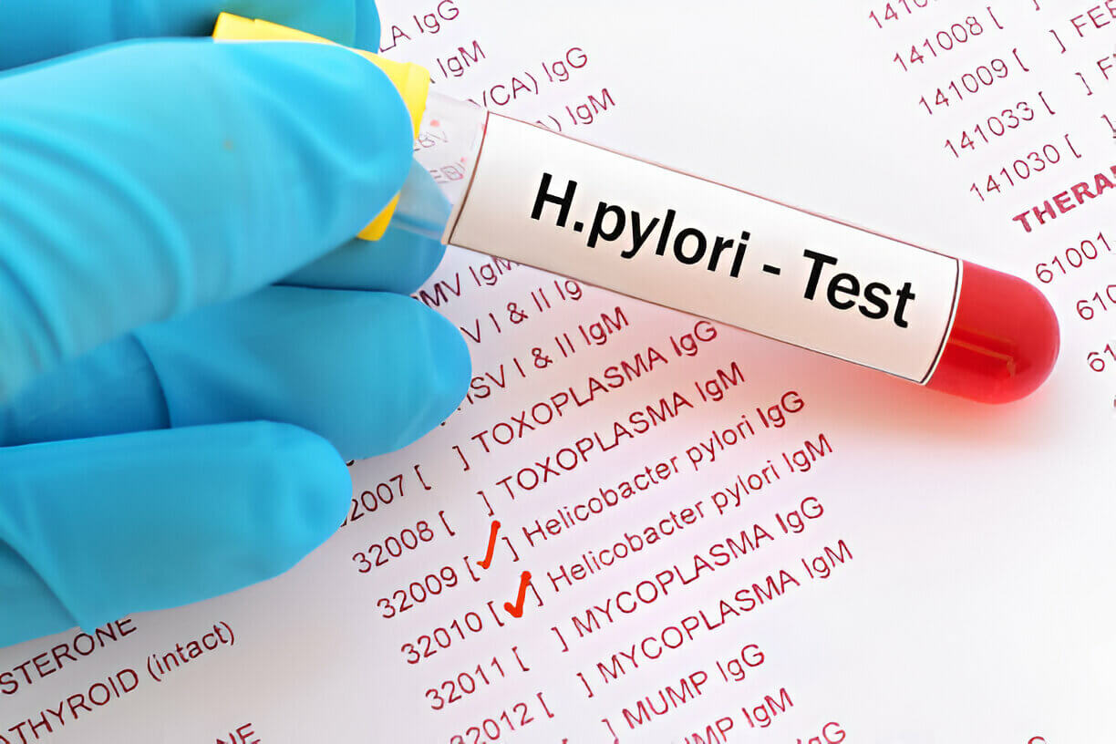 Blood sample with requisition form for Helicobacter pylori test