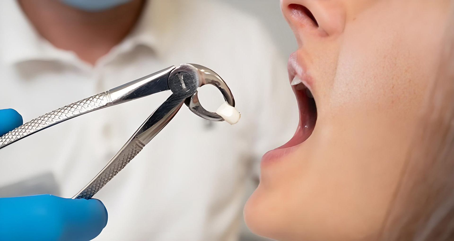 When Can You Drink Carbonated Drinks After Tooth Extraction